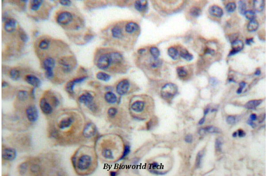 Anti-PLC β3 (L532) Antibody from Bioworld Technology (BS1787) - Antibodies.com