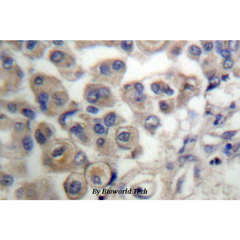 Anti-PLC β3 (L532) Antibody from Bioworld Technology (BS1787) - Antibodies.com