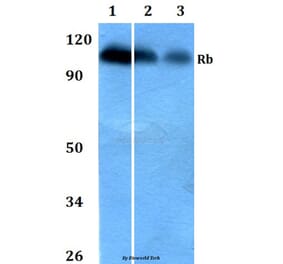 Anti-Rb (S807) Antibody from Bioworld Technology (BS1792) - Antibodies.com