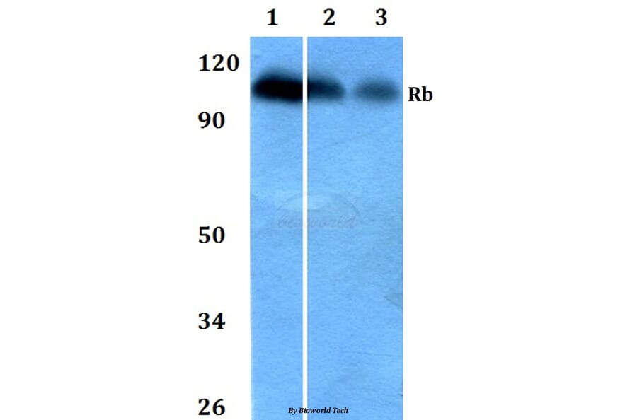 Anti-Rb (S807) Antibody from Bioworld Technology (BS1792) - Antibodies.com