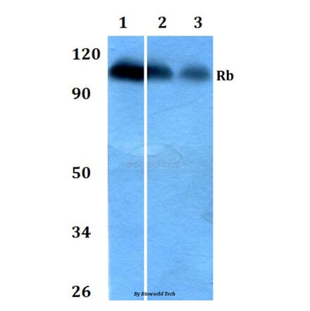 Anti-Rb (S807) Antibody from Bioworld Technology (BS1792) - Antibodies.com