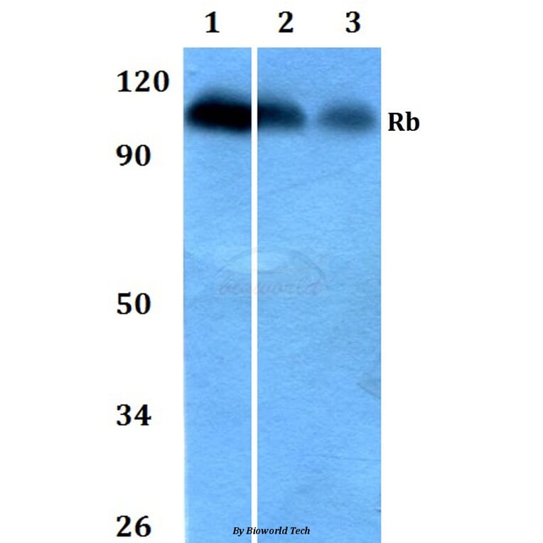Anti-Rb (S807) Antibody from Bioworld Technology (BS1792) - Antibodies.com