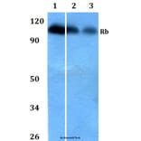 Anti-Rb (S807) Antibody from Bioworld Technology (BS1792) - Antibodies.com