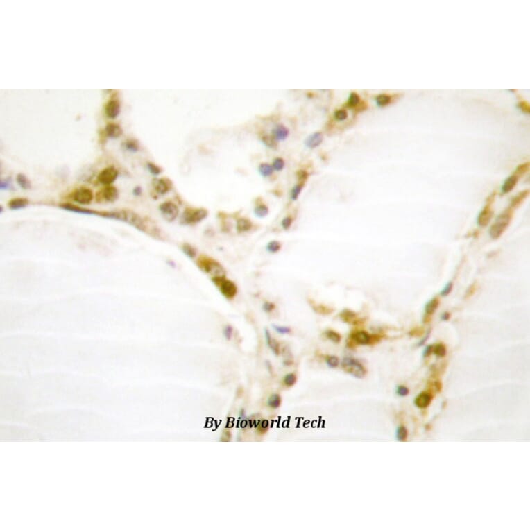 Anti-Rb (S807) Antibody from Bioworld Technology (BS1792) - Antibodies.com