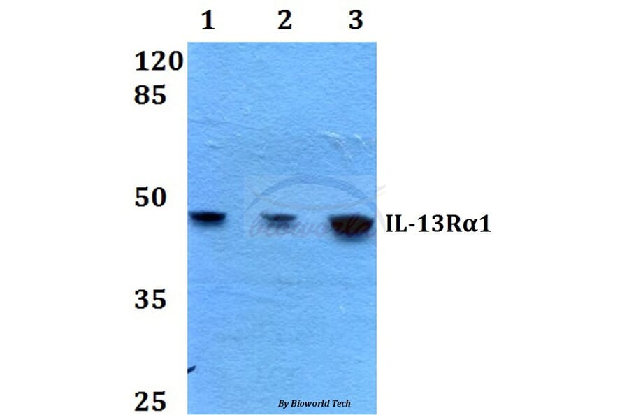 Anti-IL-13Rα1 (K401) Antibody from Bioworld Technology (BS1800) - Antibodies.com