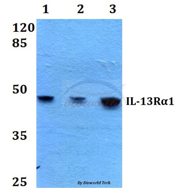 Anti-IL-13Rα1 (K401) Antibody from Bioworld Technology (BS1800) - Antibodies.com
