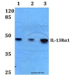Anti-IL-13Rα1 (K401) Antibody from Bioworld Technology (BS1800) - Antibodies.com
