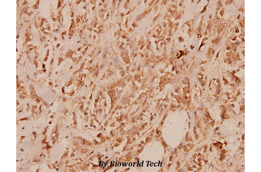 Anti-IL-13Rα1 (K401) Antibody from Bioworld Technology (BS1800) - Antibodies.com