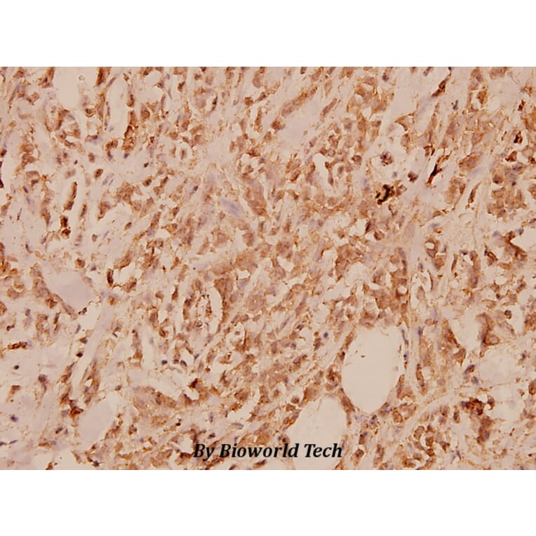 Anti-IL-13Rα1 (K401) Antibody from Bioworld Technology (BS1800) - Antibodies.com