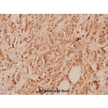 Anti-IL-13Rα1 (K401) Antibody from Bioworld Technology (BS1800) - Antibodies.com