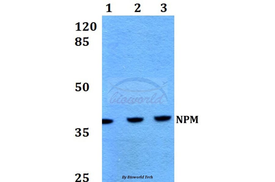 Anti-NPM (K230) Antibody from Bioworld Technology (BS1804) - Antibodies.com