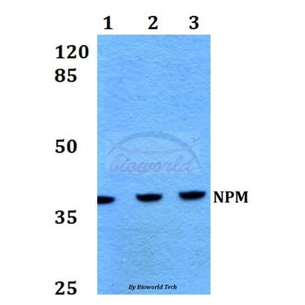 Anti-NPM (K230) Antibody from Bioworld Technology (BS1804) - Antibodies.com