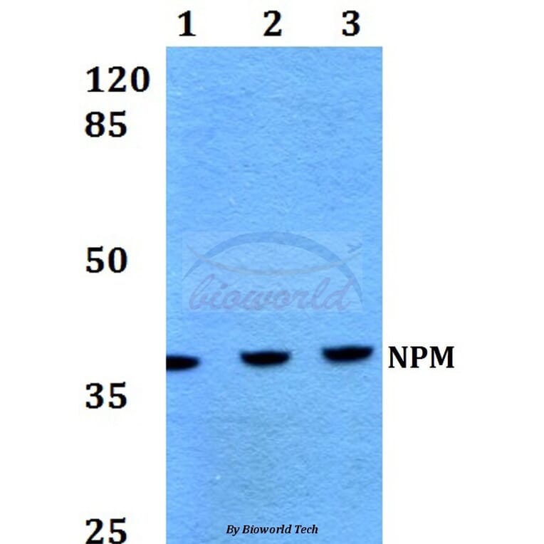 Anti-NPM (K230) Antibody from Bioworld Technology (BS1804) - Antibodies.com