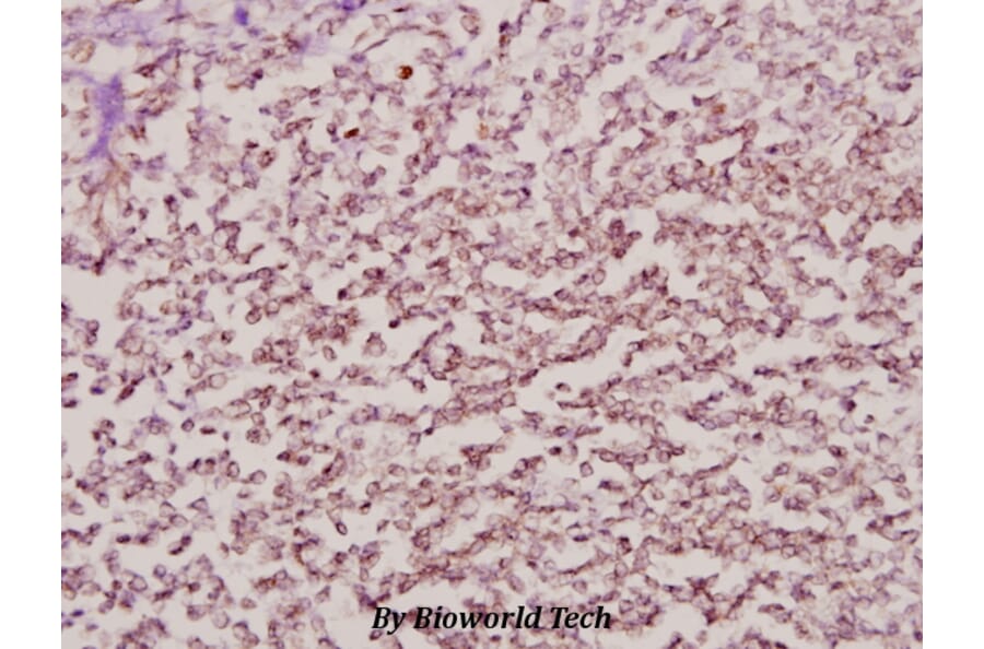 Anti-NPM (K230) Antibody from Bioworld Technology (BS1804) - Antibodies.com