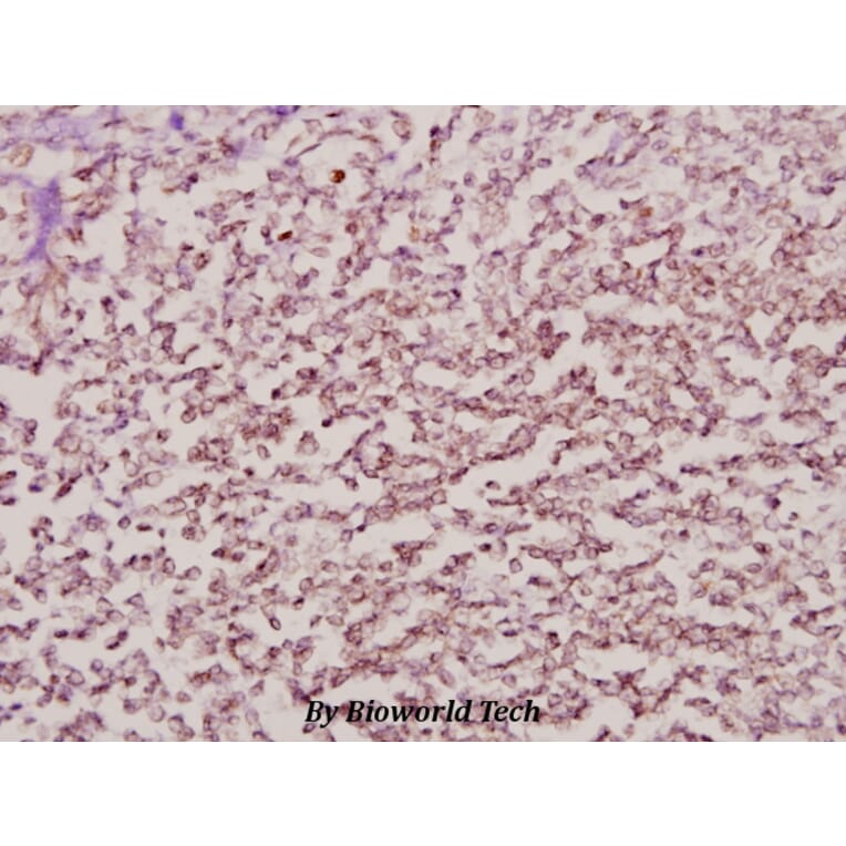 Anti-NPM (K230) Antibody from Bioworld Technology (BS1804) - Antibodies.com