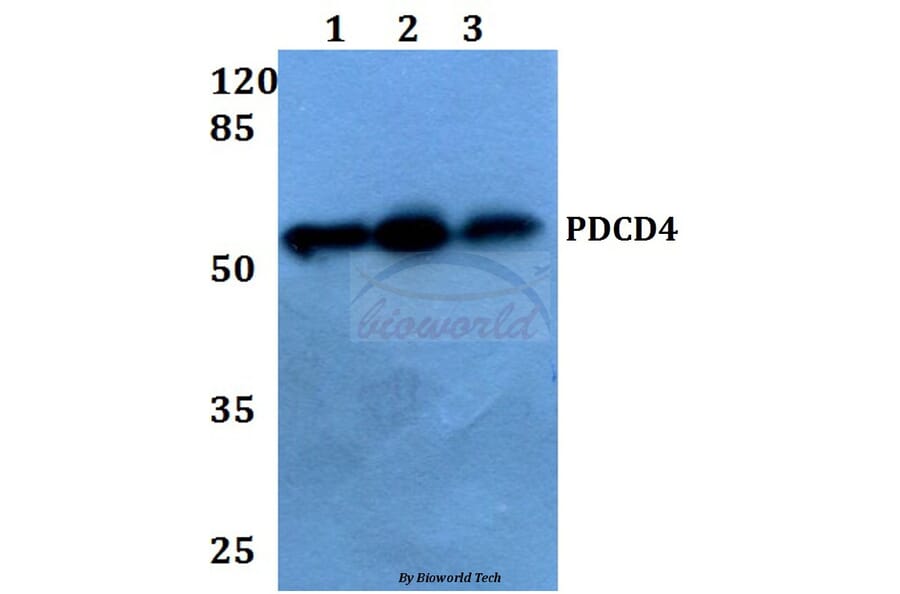 Anti-PDCD4 (K453) Antibody from Bioworld Technology (BS1805) - Antibodies.com