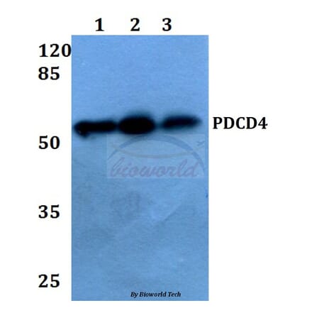 Anti-PDCD4 (K453) Antibody from Bioworld Technology (BS1805) - Antibodies.com