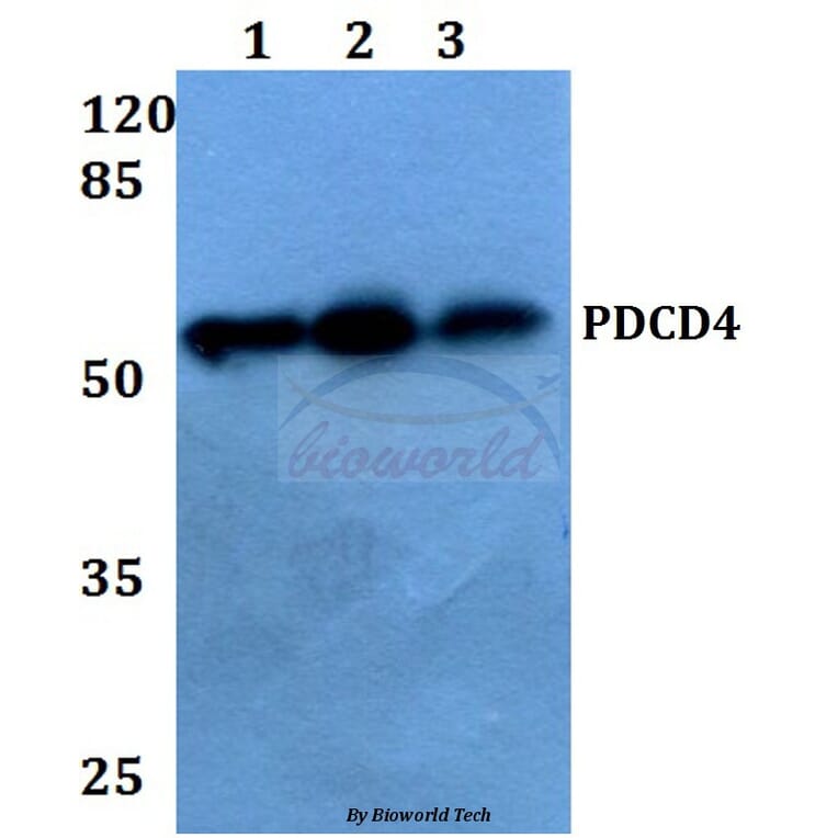 Anti-PDCD4 (K453) Antibody from Bioworld Technology (BS1805) - Antibodies.com