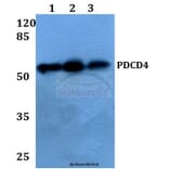 Anti-PDCD4 (K453) Antibody from Bioworld Technology (BS1805) - Antibodies.com