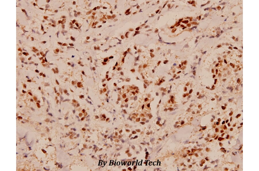 Anti-PDCD4 (K453) Antibody from Bioworld Technology (BS1805) - Antibodies.com