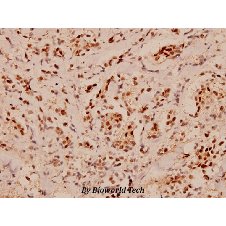 Anti-PDCD4 (K453) Antibody from Bioworld Technology (BS1805) - Antibodies.com