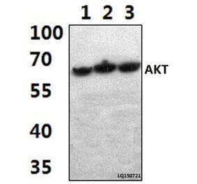 Anti-AKT (A444) Antibody from Bioworld Technology (BS1810) - Antibodies.com