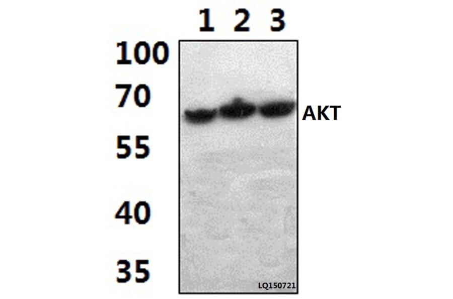 Anti-AKT (A444) Antibody from Bioworld Technology (BS1810) - Antibodies.com