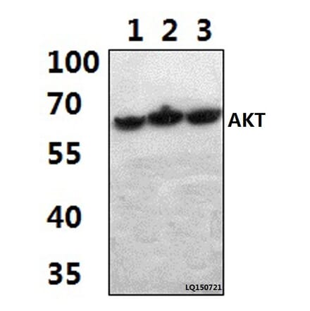 Anti-AKT (A444) Antibody from Bioworld Technology (BS1810) - Antibodies.com