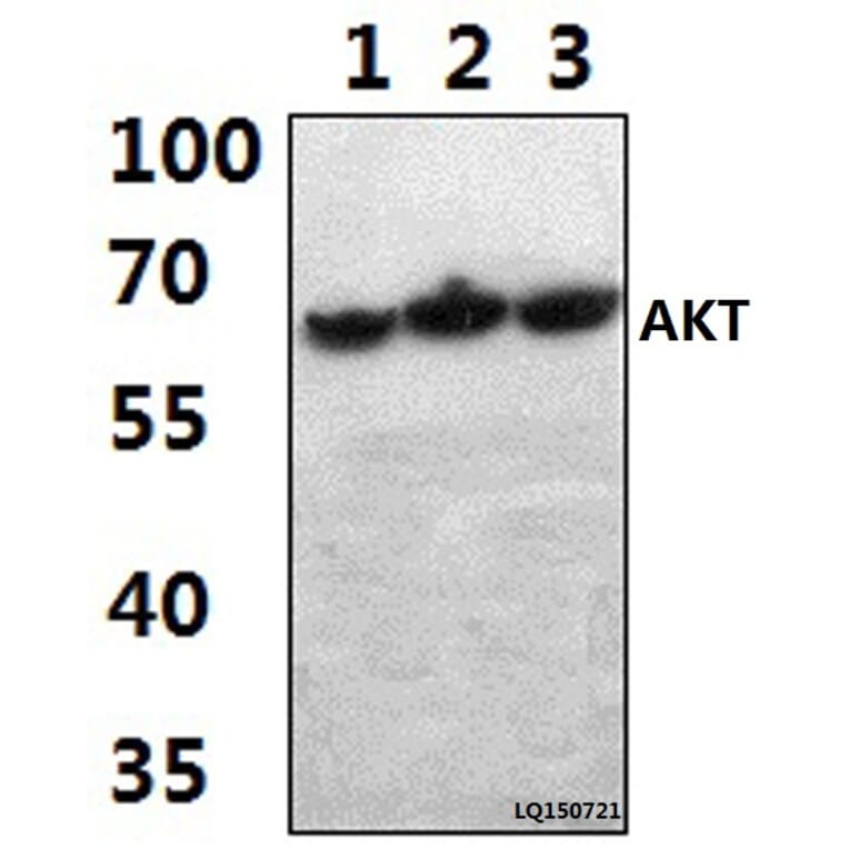 Anti-AKT (A444) Antibody from Bioworld Technology (BS1810) - Antibodies.com