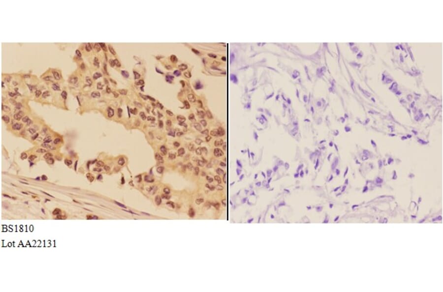 Anti-AKT (A444) Antibody from Bioworld Technology (BS1810) - Antibodies.com