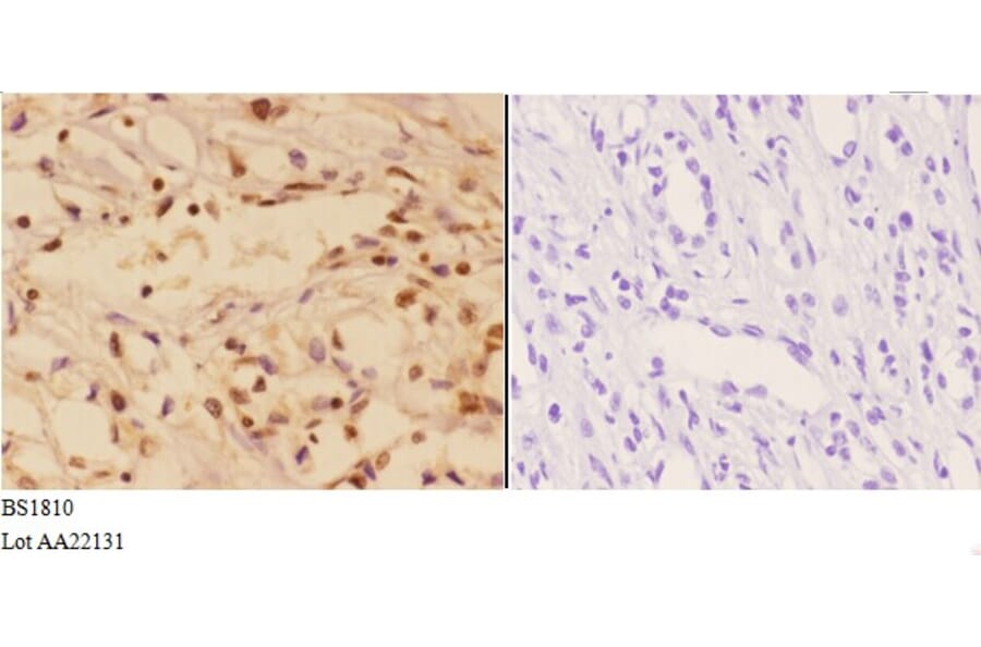 Anti-AKT (A444) Antibody from Bioworld Technology (BS1810) - Antibodies.com