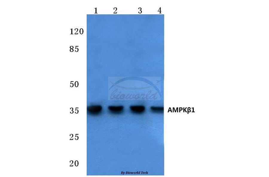 Anti-AMPKβ1 (V175) Antibody from Bioworld Technology (BS1812) - Antibodies.com