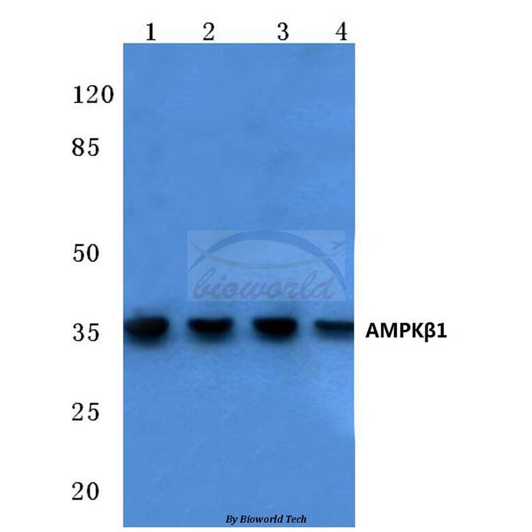 Anti-AMPKβ1 (V175) Antibody from Bioworld Technology (BS1812) - Antibodies.com