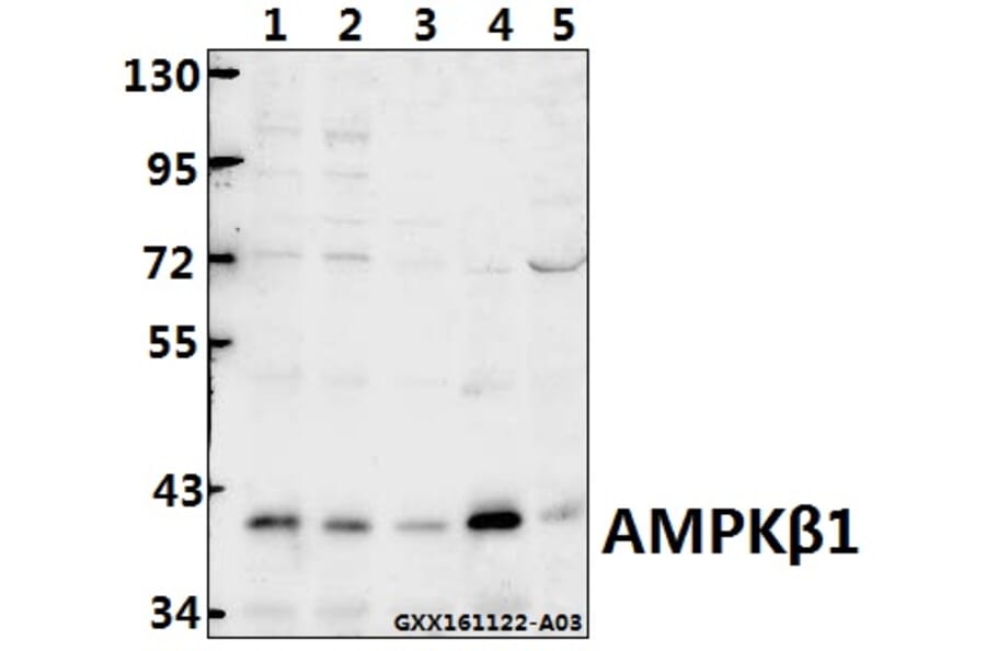 Anti-AMPKβ1 (V175) Antibody from Bioworld Technology (BS1812) - Antibodies.com