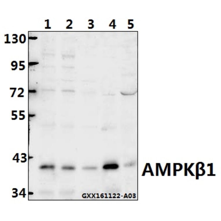 Anti-AMPKβ1 (V175) Antibody from Bioworld Technology (BS1812) - Antibodies.com