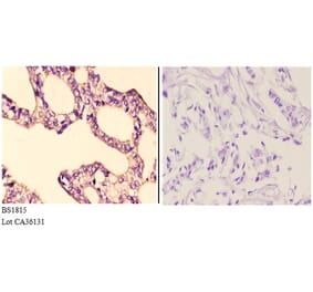Anti-IKKα/β (D173) Antibody from Bioworld Technology (BS1815) - Antibodies.com