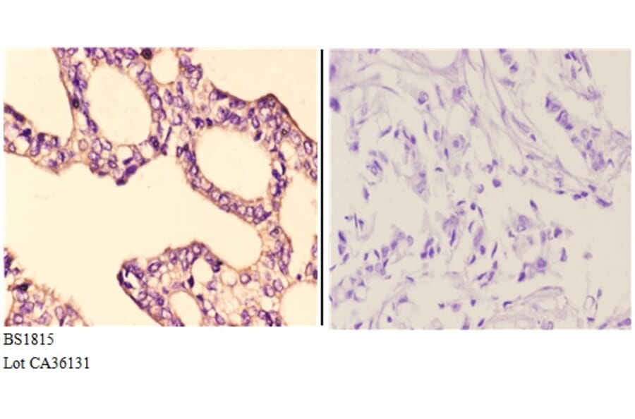 Anti-IKKα/β (D173) Antibody from Bioworld Technology (BS1815) - Antibodies.com