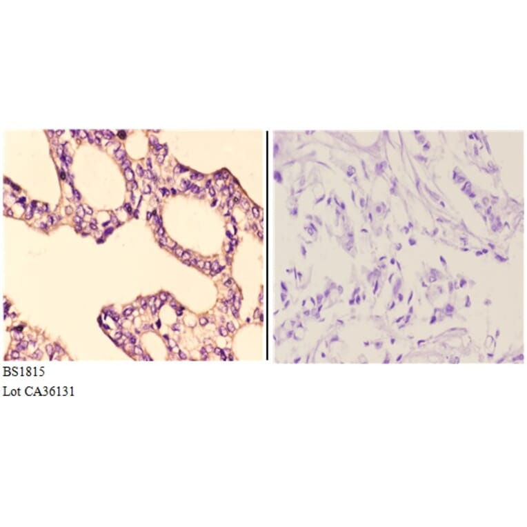 Anti-IKKα/β (D173) Antibody from Bioworld Technology (BS1815) - Antibodies.com