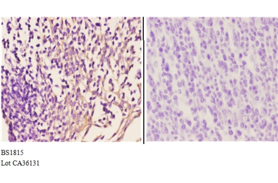 Anti-IKKα/β (D173) Antibody from Bioworld Technology (BS1815) - Antibodies.com