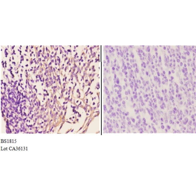 Anti-IKKα/β (D173) Antibody from Bioworld Technology (BS1815) - Antibodies.com