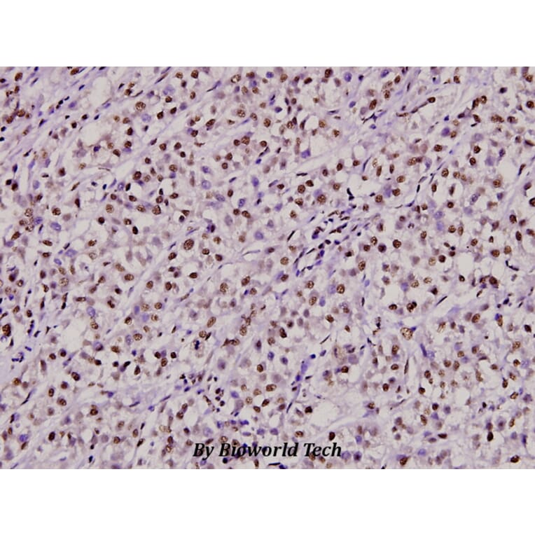 Anti-Ku-70 (S1) Antibody from Bioworld Technology (BS1818) - Antibodies.com