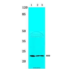 Anti-BID (I72) Antibody from Bioworld Technology (BS1819) - Antibodies.com