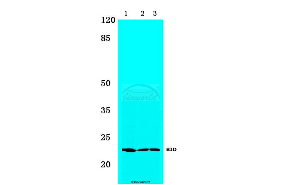 Anti-BID (I72) Antibody from Bioworld Technology (BS1819) - Antibodies.com