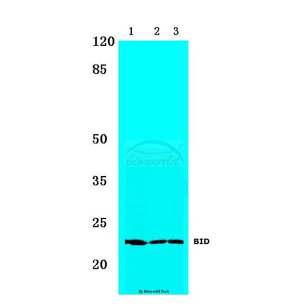 Anti-BID (I72) Antibody from Bioworld Technology (BS1819) - Antibodies.com