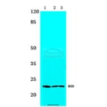 Anti-BID (I72) Antibody from Bioworld Technology (BS1819) - Antibodies.com
