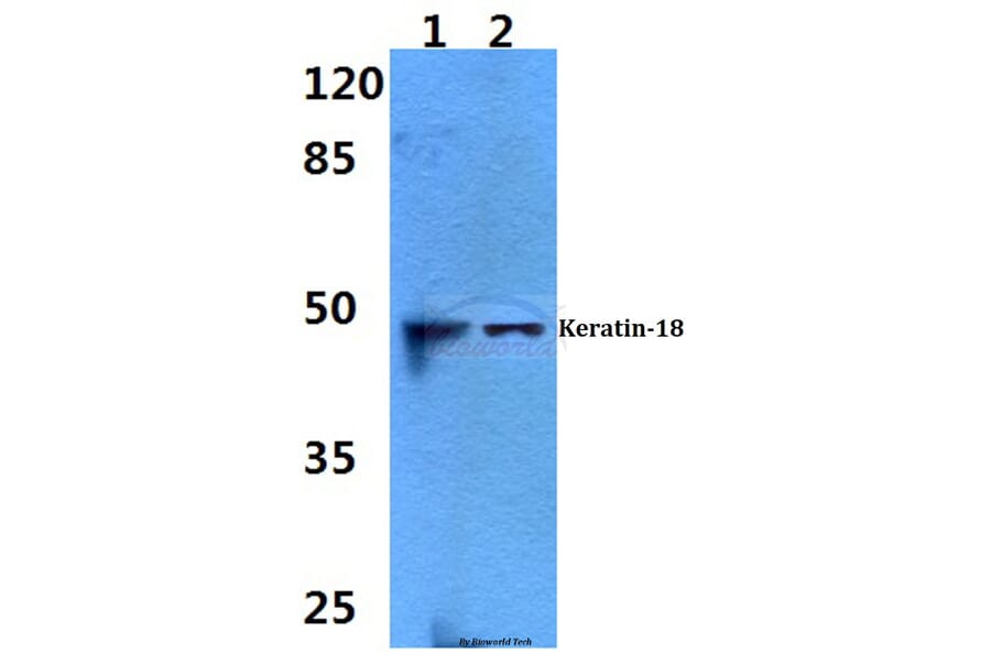 Anti-Cytokeratin 18 (S48) Antibody from Bioworld Technology (BS1833) - Antibodies.com