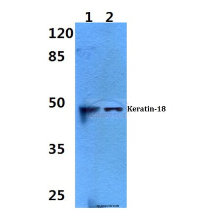 Anti-Cytokeratin 18 (S48) Antibody from Bioworld Technology (BS1833) - Antibodies.com
