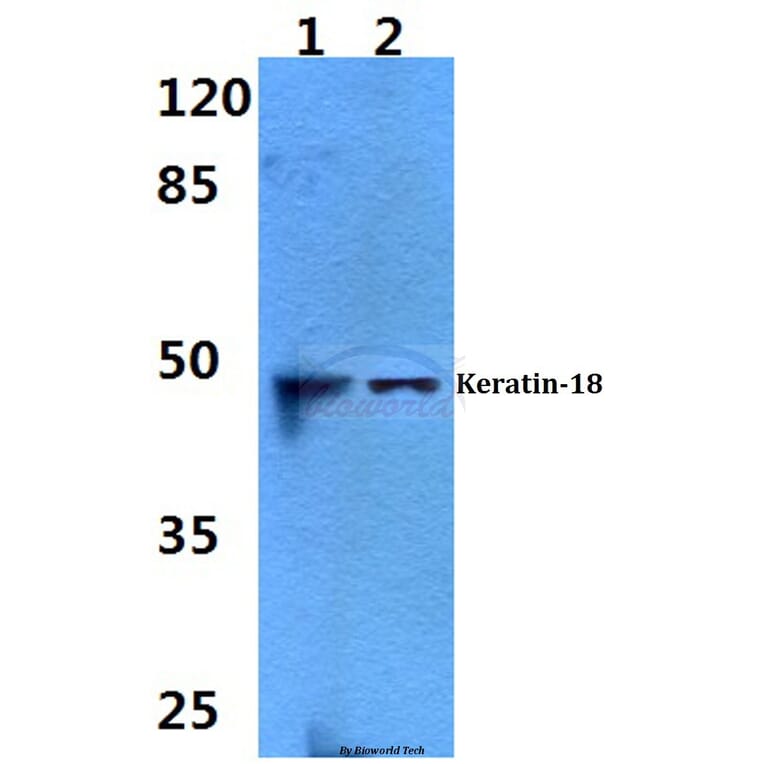 Anti-Cytokeratin 18 (S48) Antibody from Bioworld Technology (BS1833) - Antibodies.com