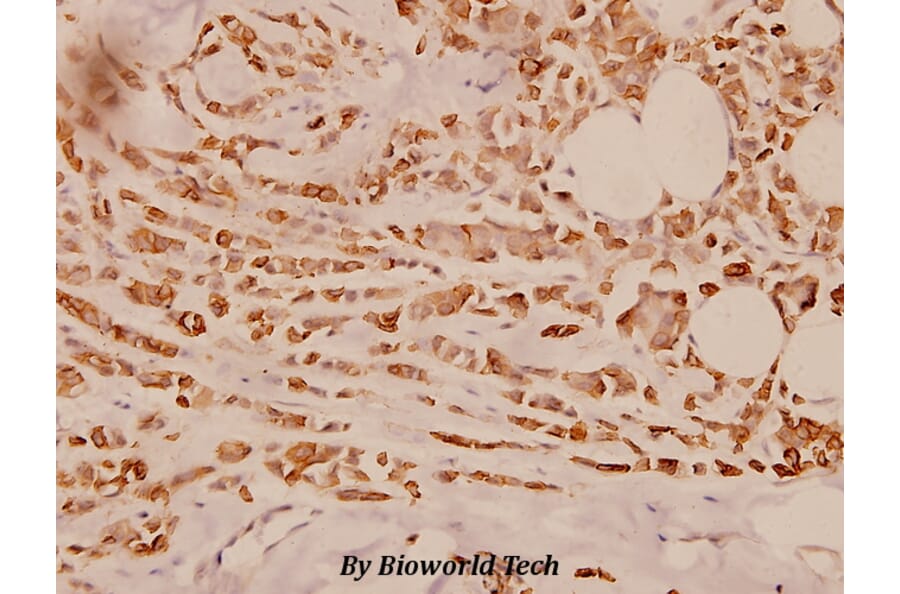 Anti-Cytokeratin 18 (S48) Antibody from Bioworld Technology (BS1833) - Antibodies.com