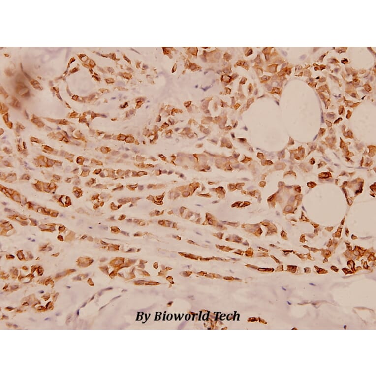 Anti-Cytokeratin 18 (S48) Antibody from Bioworld Technology (BS1833) - Antibodies.com